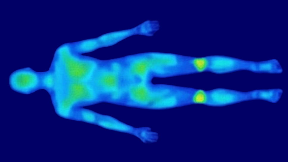 Mappa di pressione materasso ad acqua AKVA